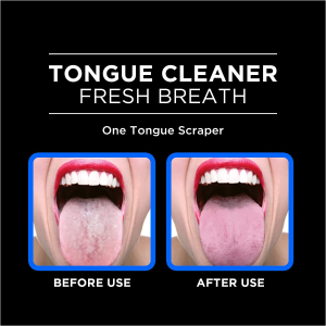 Orabrush Tongue Scraper, Tongue Cleaner Helps Fight Bad Breath, 4 Tongue Scrapers